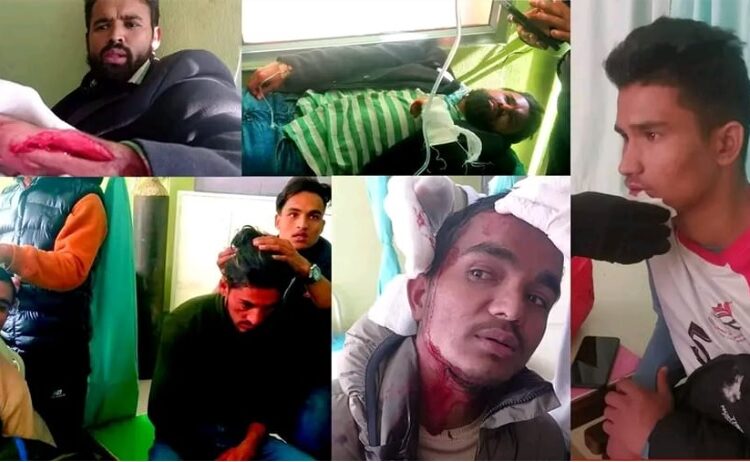 अनेरास्ववियुनिकट विद्यार्थीहरूबीच आपसी झगडा हुँदा चार घाइते