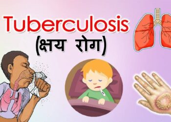 आठ बालबालिकामा क्षयरोग सङ्क्रमण