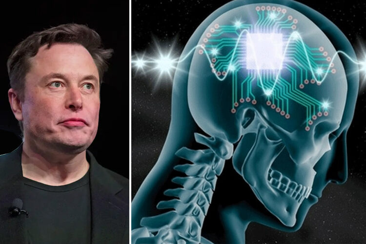 मानव मस्तिष्कमा चिप प्रत्यारोपणका लागि अनुमति पायो