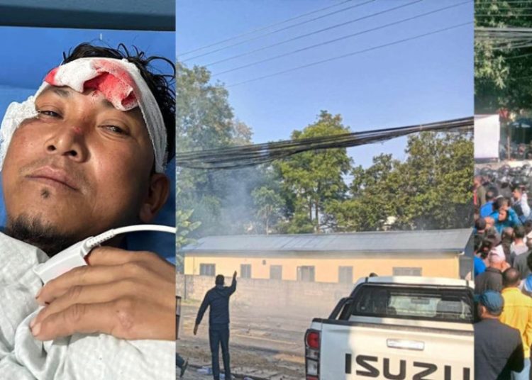 रास्वपा समर्थक र प्रहरीबीचको झडपमा ६० जना घाइते