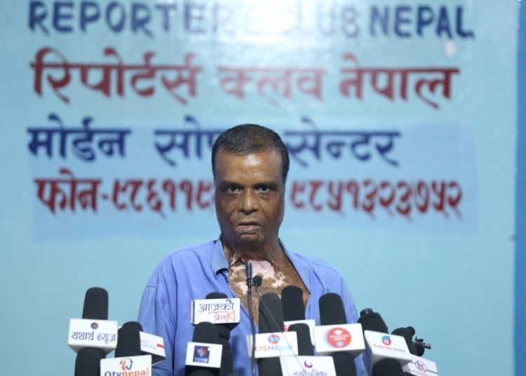 अफ्ताब आलम प्रकरण : बम लागेका गौरीशंकरले सुनाए यस्तो पीडा